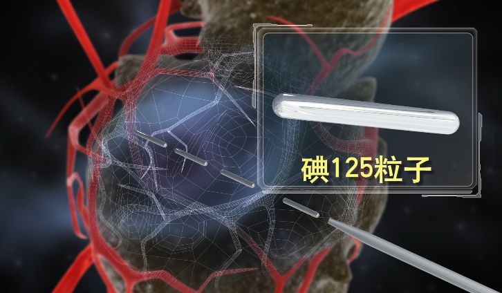 圖片1、小粒子，大能量.jpeg